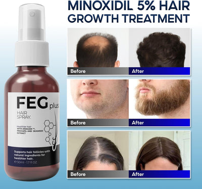 FEGPLUS Minoxidil Hair & Beard Growth Serum (50ml) Thicker and Stronger Hair Spray